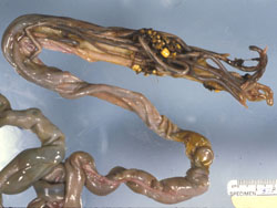 Baylisascariasis: Raccoon, intestine. This partially opened small intestine contains many adult B. procyonis.