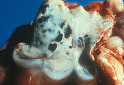 Bluetongue: Sheep, pulmonary artery. There are multiple ecchymoses on the intimal surface. 