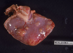 Coccidioidomicosis: Marsupial, riñon. El riñon esta deformado por múltiples nódulos pálidos elevados y firmes de varios tamaños (granulomas). 