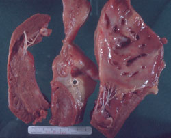 Equine Infectious Anemia: Horse, heart. Pale cardiac muscle, focal white areas of myocardial degeneration, and reddened hemorrhagic areas (possible hypoxia during death).