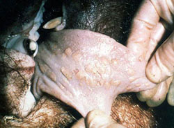 Foot and Mouth Disease: Pig, tongue. Many ("dry") vesicles are ruptured and lack fluid.