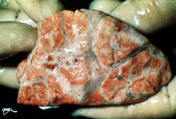 Dermatosis Nodular Contagiosa: Bovino, pulmón. Hay marcado edema interlobular generalizado, y se observa un pequeño grupo de nódulos rojos en el lado izquierdo de la muestra.