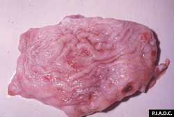 Fiebre Catarral Maligna: Bovino, vejiga. La superficie mucosa contiene varias erosiones pequeñas y una úlcera hemorrágica grande. 
