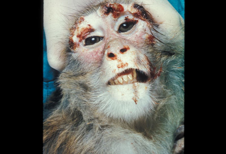 monkeypox - photo #31