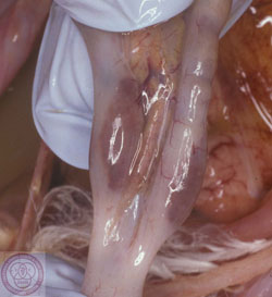 Maladie de Newcastle : Volaille, caecums. Les amygdales caecales nécrotiques et hyperémique sont visibles à partir de la surface séreuse.