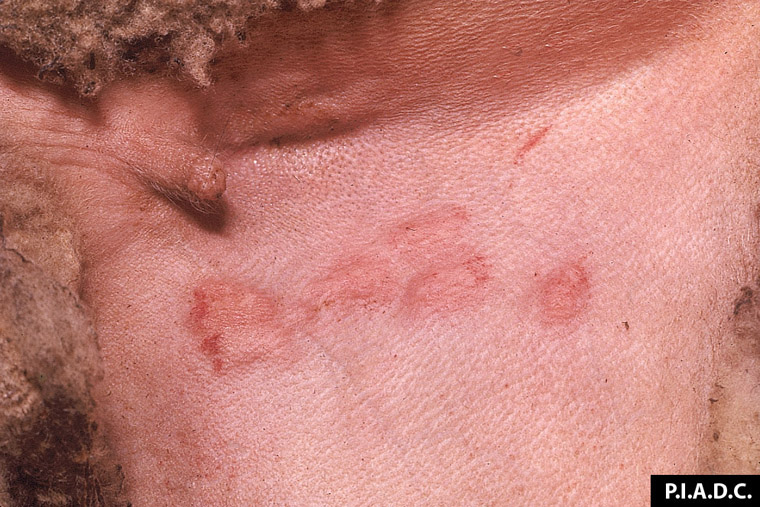 sheep-pox-and-goat-pox: Sheep, inguinal skin. Several coalescing macules contain petechiae.