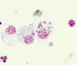 Toxoplasmosis: Cat, transtracheal aspirate. This transtracheal aspirate fluid contains macrophages with intracytoplasmic Toxoplasma gondii. 