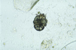 Sarna y Escabiosis: Una hembra adulta del parásito Sarcoptes scabeii.  
