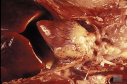 Avian Influenza: Chicken, heart. There are numerous epicardial petechiae.