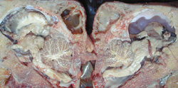 Akabane: Novillo bovino,  cavidad craneal. Los hemisferios cerebrales están moderados a severamente reducidos en tamaño y no llenan la bóveda craneana. El espacio contiene líquido cefalorraquídeo (hidrocefalia).