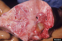 Peste Porcina Africana: Cerdo. Pulmón. El pulmón edematoso,  no está colapsado; hay una hemorragia dorsal y una consolidación ventral café-claro.