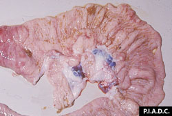 Peste porcine africaine: Porc, caecum. La muqueuse est fortement œdémateuse et hyperémique, et les nœuds lymphatiques sont hémorragiques.