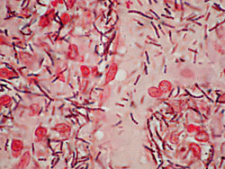 Ántrax: El Bacillus anthracis es un bacilo grande con punta roma a cuadrada que forma cadenas cortas.