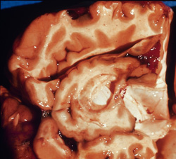 Bovine Babesiosis: Bovine, brain. The cerebral cortex is diffusely reddened (“cerebral flush”).