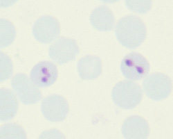 Bovine Babesiosis: Bovine, blood smear. Two erythrocytes contain pairs of ovoid Babesia bovis.