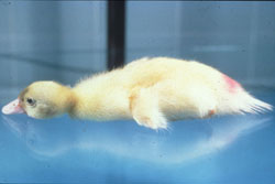 Botulism: Duck. Flaccid paralysis characteristic of botulism. 
