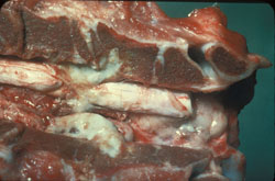 <i>Brucella abortus</i>: Bovino, espina dorsal. Exudado purulento en una de las vértebras se extiende a la medula espinal adyacente.