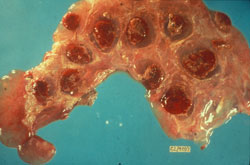 <i>Brucella abortus</i>: Bovino, placenta. La placenta contiene numerosos cotiledones hemorrágicos. 
