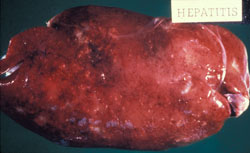 Campylobacteriosis: Avian, liver. Swollen liver with rounded edges and multifocal white lesions due to Campylobacterosis.