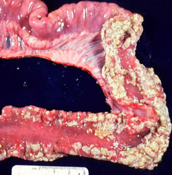 Campylobacteriosis: Pig, small intestine.  White to tan multifocal luminal exudate within the small intestine.