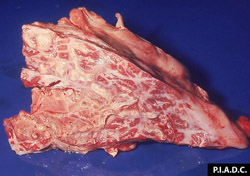 Pleuroneumonía Contagiosa Bovina: Bovino, pulmón. La pleura y los tabiques interlobulares adyacentes están severamente engrosados por tejido fibroso. El parénquima pulmonar en la parte inferior izquierda tiene una apariencia pálida  y amarronada.