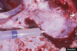 Contagious Bovine Pleuropneumonia: Bovine, heart. The pericardial sac contains abundant pale turbid fluid.