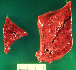 Coccidioidomycosis: Dog, lung. Cross section of lung reveals multifocal to coalescing pale firm areas (granulomas).