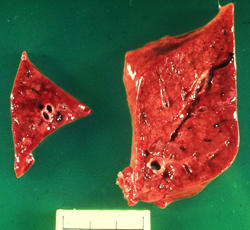 Coccidioidomicosis: Perro, pulmón. Corte transversal de un púlmon que muestra areas multifocales firmes pálidas que coalescen. 