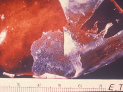 Clamidiosis Aviar: Ave, hígado. Láminas de exudado fibrinoso cubren parcialmente la superficie capsular del hígado.