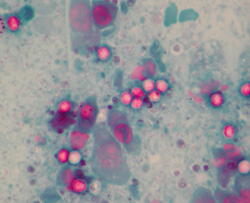 Cryptosporidiosis: Bovine, intestinal impression smear. Cryptosporidia in this preparation are acid-fast (red), round and have faint halos.