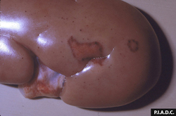 Classical Swine Fever: Pig, kidney. The cortex contains multiple petechiae and pale infarcts surrounded by hemorrhage.