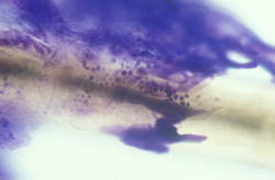 Dermatophytosis: Dog, hair shaft, cytology. There are clusters of purple-blue arthrospores associated with the hair shaft. 