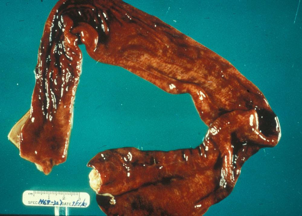 escherichia-coli: Canine, small intestine. Hemorrhagic enteritis due to E. coli 0157:H7.