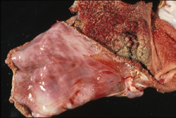 Epizootic Hemorrhagic Disease: Deer, rumen and reticulum. The serosal surface of the rumen has fine linear to coalescing hemorrhages, and there is extensive congestion and hemorrhage of the ruminal and reticular mucosa.