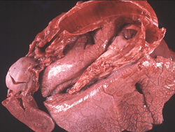 Epizootic Hemorrhagic Disease: Deer, lungs and trachea. There is moderate to marked widening of interlobular septa (edema). The tracheal mucosa is diffusely congested and contains several blood clots, and there are a few small pleural hemorrhages.
