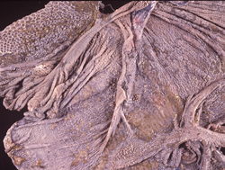 Epizootic Hemorrhagic Disease: Deer, rumen and reticulum (preserved specimen). The mucosa contains numerous, variably-sized areas of erosion and ulceration.