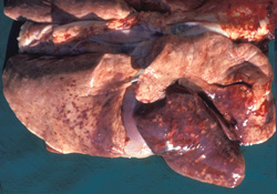 Ehrlichiosis: Dog, lungs, Ehrlichia canis. There are multiple coalescing hemorrhages on the pleural surface; the right middle lobe is also edematous.