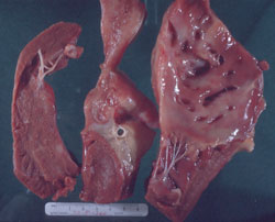 Anemia Infecciosa Equina: Equino, corazón. El músculo cardíaco está pálido, hay focos blancos de degeneración  miocárdica, y áreas hemorrágicas (posiblemente debidas a la hipoxia al morir). 