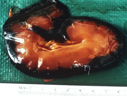 Piroplasmosis Equina: Equino, riñón. La corteza tiene una coloración roja oscura debido a hemoglobinemia. La médula y pelvis están ictéricas. 