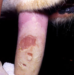 Foot and Mouth Disease: Bovine, tongue. A large area of undermined epithelium (bulla) is centrally eroded; this lesion probably resulted from coalescence of several smaller lesions.