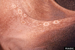 Fièvre aphteuse: Bovin, muqueuse du rumen, sac dorsal, faible grossissement. Plusieurs érosions de forme irrégulière (vésicules rompues) sur les piliers. L’épithélium atteint comporte des vésicules rompues aux bords pâles.