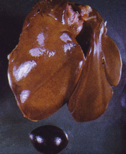 Fowl Typhoid and Pullorum Disease: Avian liver, spleen. Liver is pale with diffuse yellow-brown (bronze) discoloration; splenic congestion and enlargement.