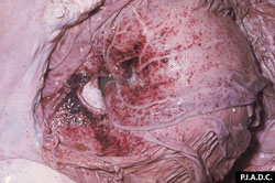 Cowdriosis: Pequeño rumiante, abomaso. La mucosa contiene petequias diseminadas y hemorragias equimóticas coalescentes.