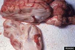 Heartwater: Goat, brain. Section of the cerebrum reveals multiple petechiae and a few ecchymoses. The choroid plexus is severely enlarged due to acute inflammation and hemorrhage, and protrudes from the lateral ventricle.