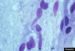 Cowdriosis: Caprino, frotis de cerebro. Una  célula endotelial contiene una mórula de Ehrlichia ruminantium