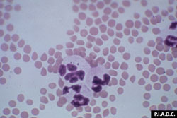 Cowdriosis: Caprino, frotis de sangre periférica. Un neutrófilo contiene algunos  E. ruminantium.