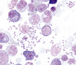 Leishmaniasis: Dog, bone marrow. Higher magnification of bone marrow demonstrating intracellular and extracellular Leishmania sp. organisms.