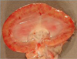 Leptospirosis: Dog, kidney. The cortex has a pale mottled to striated appearance consistent with tubulointerstitial nephritis. 