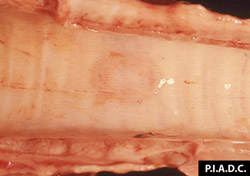 Dermatosis Nodular Contagiosa: Bovino, tráquea. La mucosa contiene un foco redondeado pobremente demarcado, rodeado por una leve hemorragia (lesión variólica temprana).