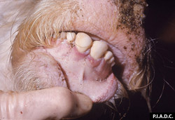 Fiebre Catarral Maligna: Bovino, mucosa oral. Hay hiperemia gingival y erosión focal.